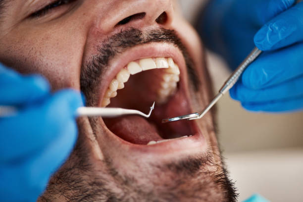 Best Emergency Treatment for Dental Infections or Abscesses in Crestwood, MO