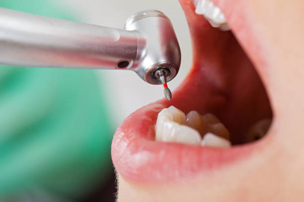 Best Weekend Emergency Dentist in Crestwood, MO